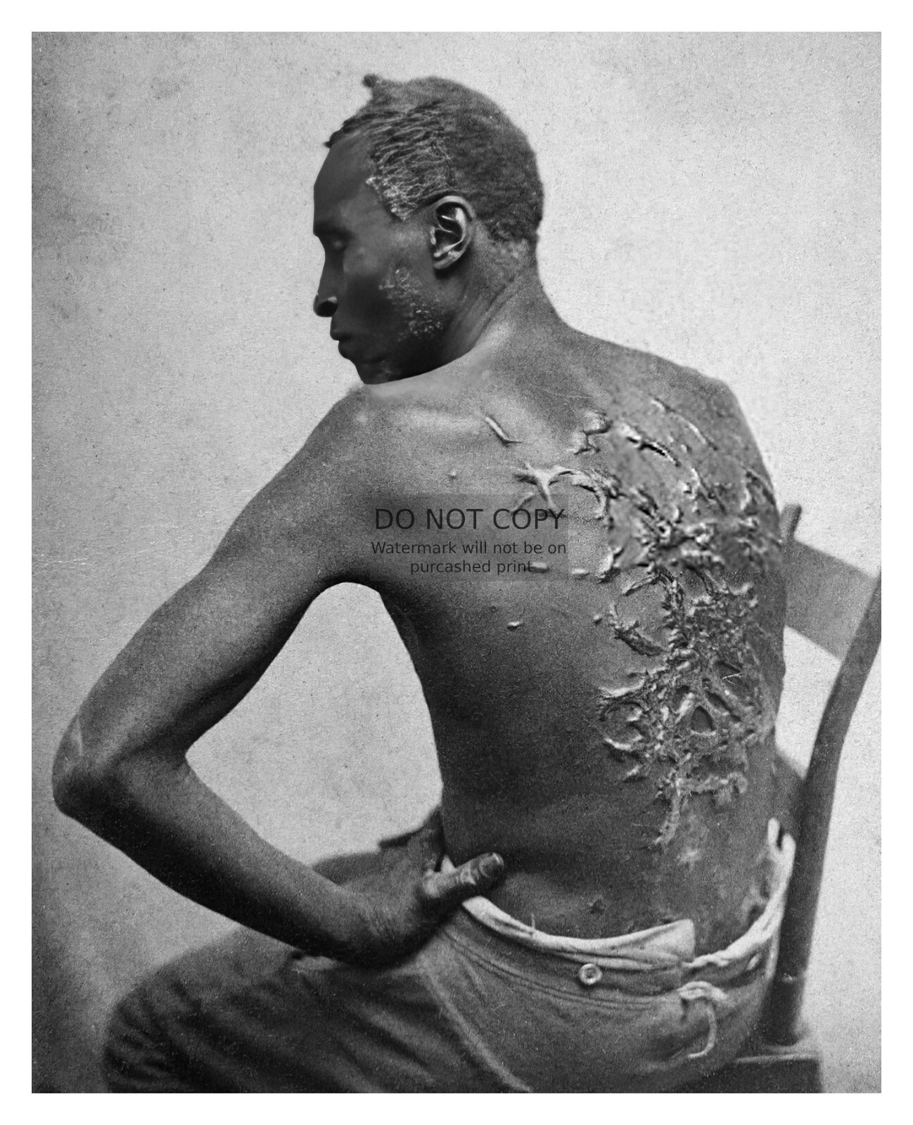 AFRICAN AMERICAN SLAVE ENSLAVED MANS SCARRED BACK 1863 8X10 PHOTO